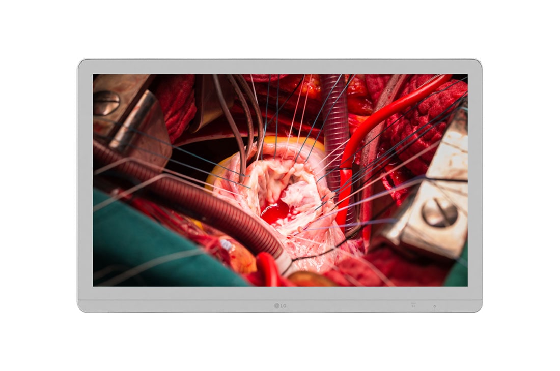 LG 27'' UHD 8MP Surgical Monitor, 27HJ710S-W
