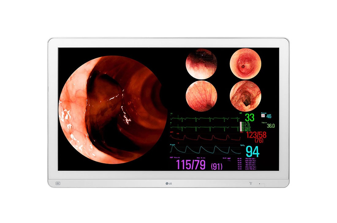LG ???? LCD IPS 4K ???????? 32 ????, 32HL710S-W