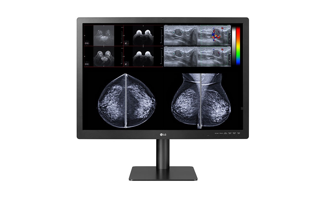 LG Monitor de Diagnóstico para Mamografía IPS 12MP de 31'' LG, 31HN713D-B, 31HN713D-B