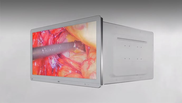 Video thumbnail : LG 手術外科顯示器