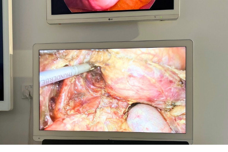 Surgical Monitors