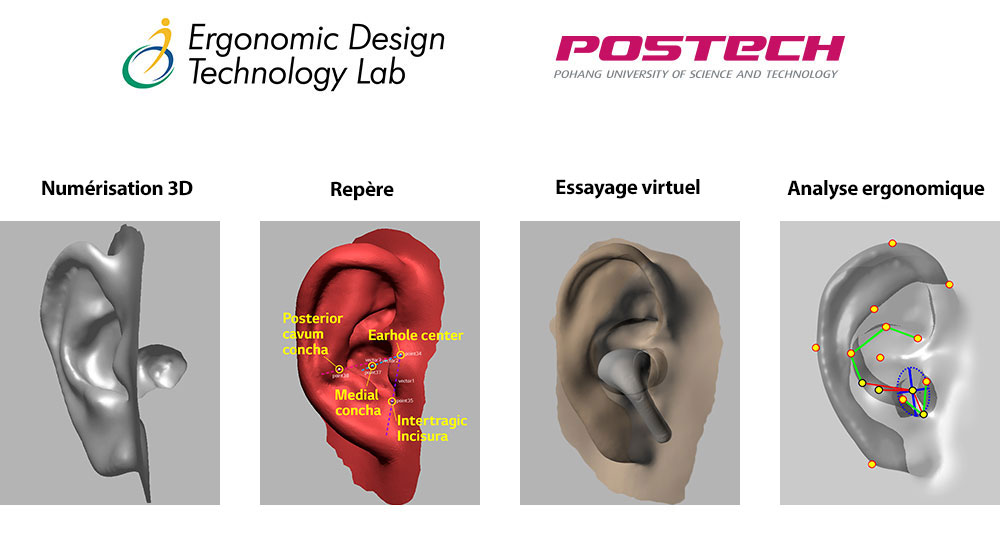 Une image dans laquelle l'image de modélisation de l'oreille en forme 3D est développée en 4?étapes au total.