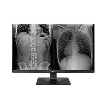 Diagnostic Monitor