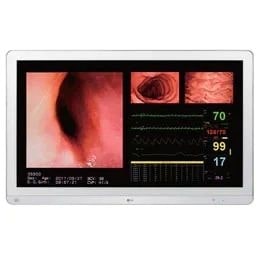 Monitor de cirurgía