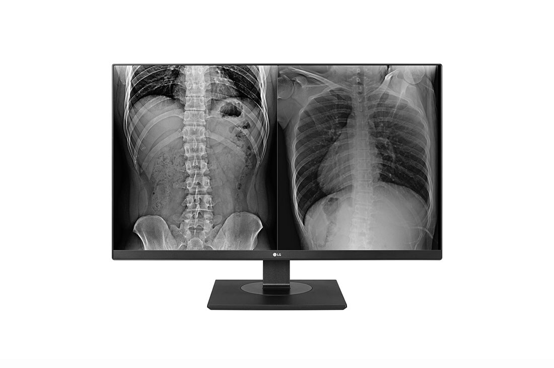 LG 27'' 8MP kliininen arviointin?ytt?, 27HJ713C-B