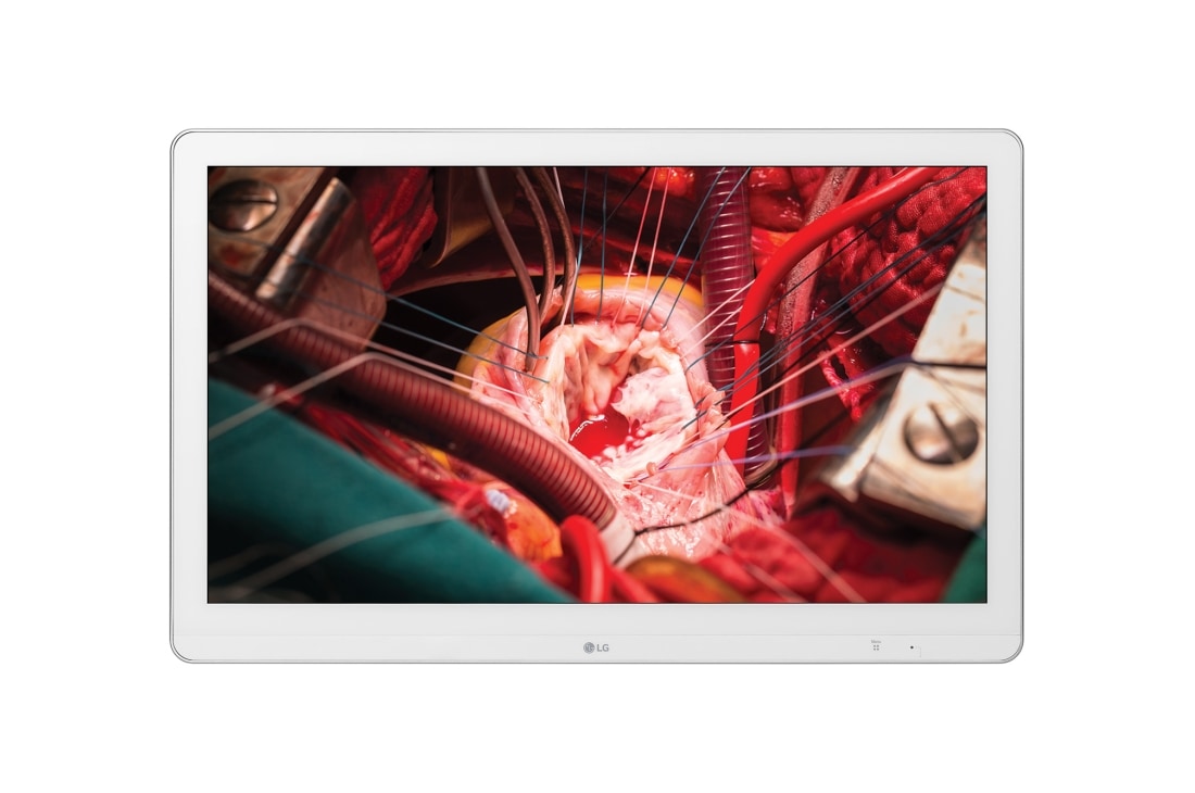 LG 27'' Full HD IPS Surgical Monitor, 27HK510S