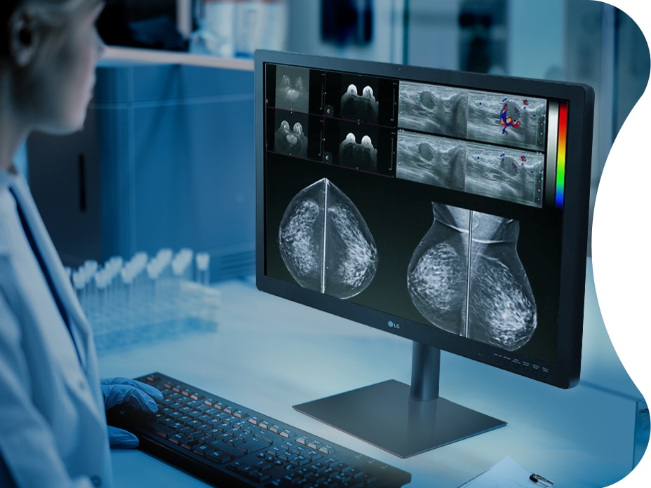 31HN713D has a large 31-inch screen with a high resolution of 12MP and is equipped with a front sensor to perform self-calibration. 