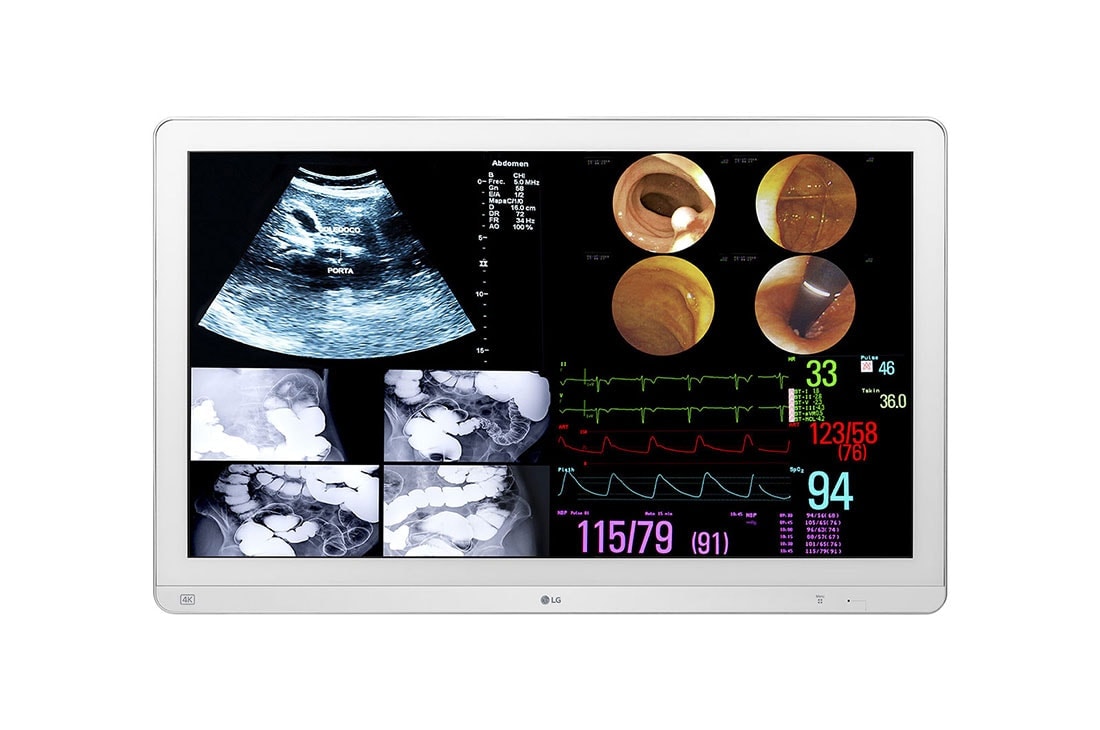 LG 31.5'' 4K IPS Surgical Monitor	, Front view, 32HL714S
