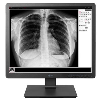 MEDICAL MONITORS