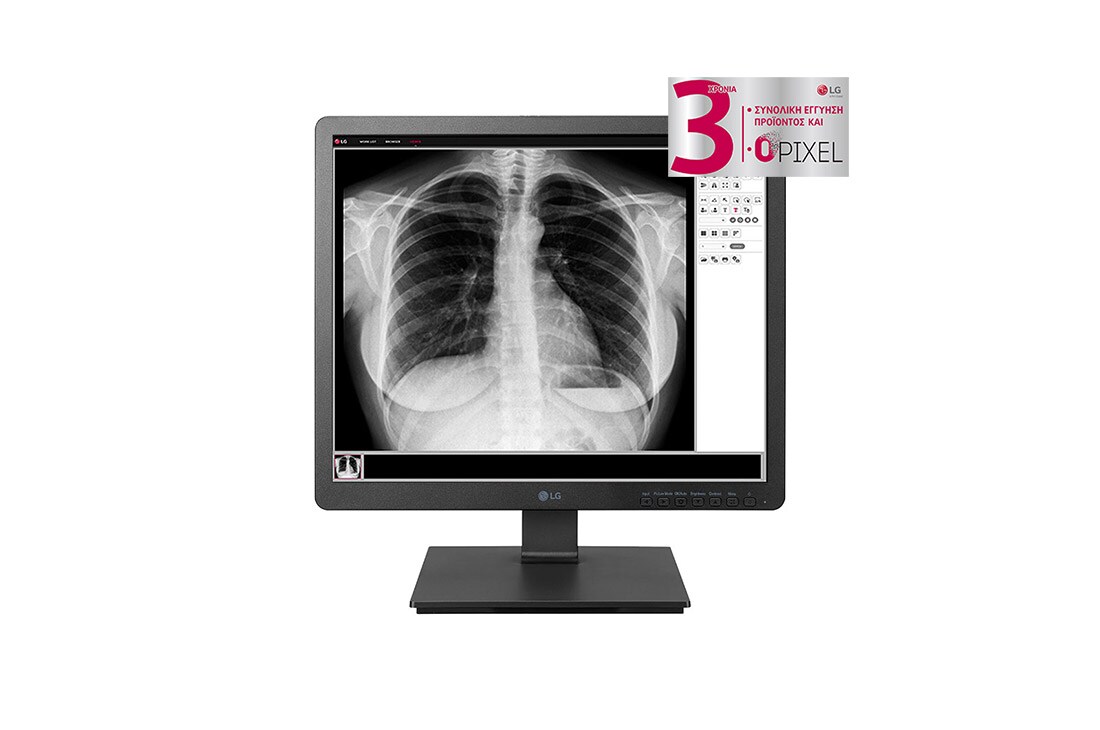 LG Μ?νιτορ 19'' Εφαρμογ?ν Κλινικ?? Αξιολ?γηση? 19HK312C DICOM Part 14 1280X1024, LG Μ?νιτορ 19'' Εφαρμογ?ν Κλινικ?? Αξιολ?γηση? 19HK312C DICOM Part 14, 19HK312C, 19HK312C