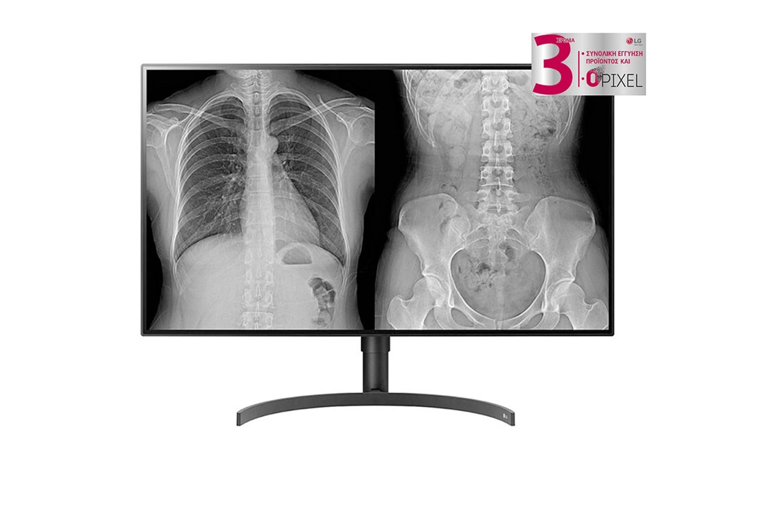 LG 31,5'' Διαγνωστικ? μ?νιτορ LG 8MP, Front view, 32HL512D-B