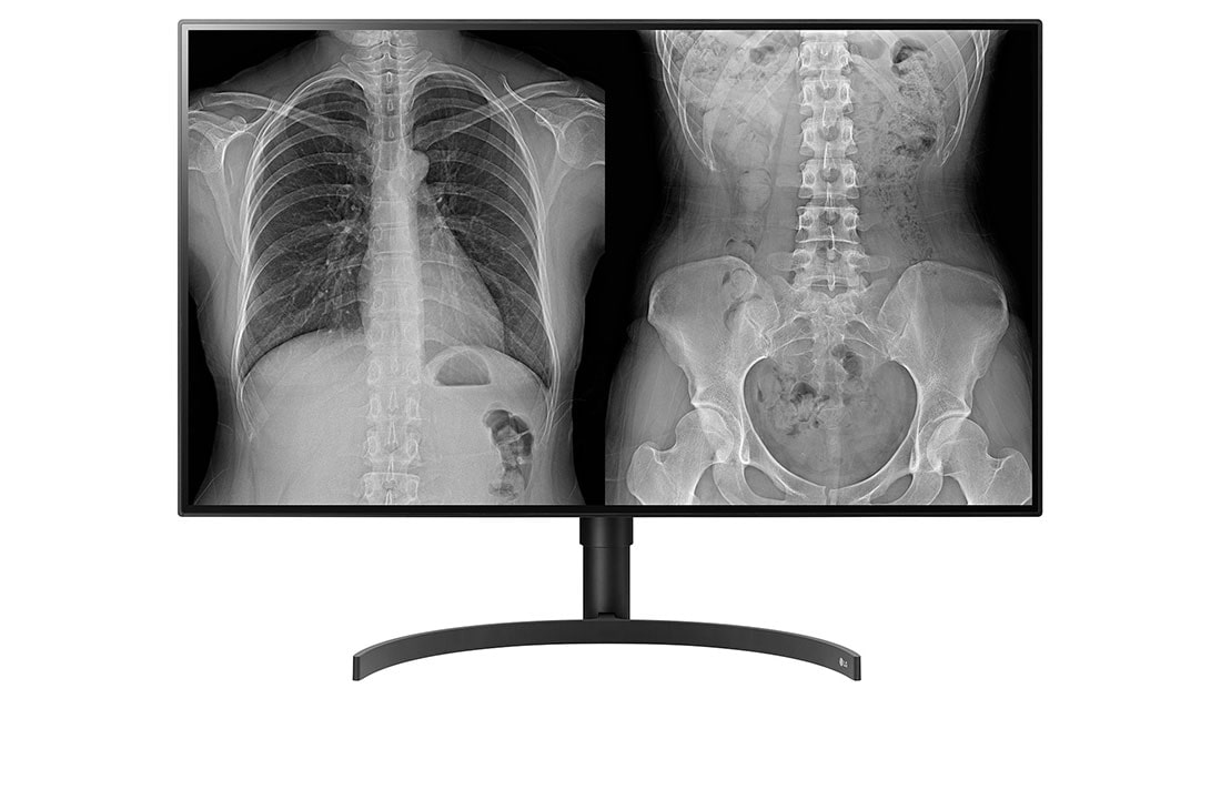 LG 32” 16:9 omjer slike 8MP IPS medicinski monitor, front view , 32HL512D-M