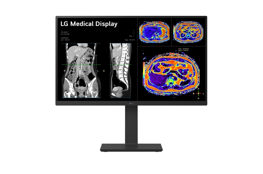 LG 27” 16:9 omjer slike 8MP IPS medicinski monitor, prikaz prednje strane, 27HS713C-B