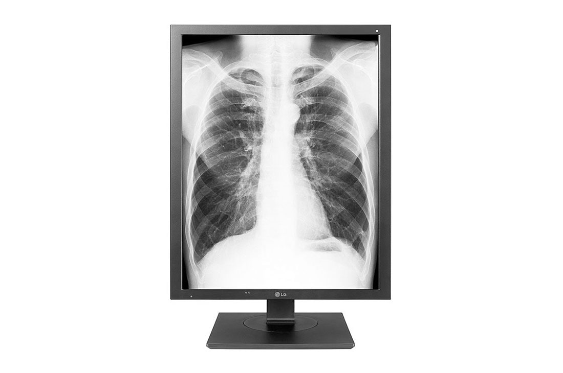 LG 21.3 '' LG 3MP dijagnosti?ki monitor, 21HK512D-B