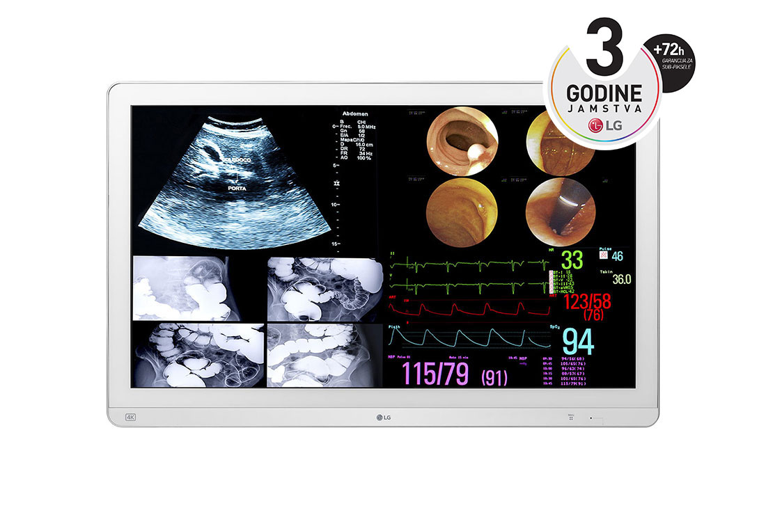 LG 31,5'' 4K(3840x2160) IPS kirur?ki monitor, prikaz prednje strane, 32HL714S-W