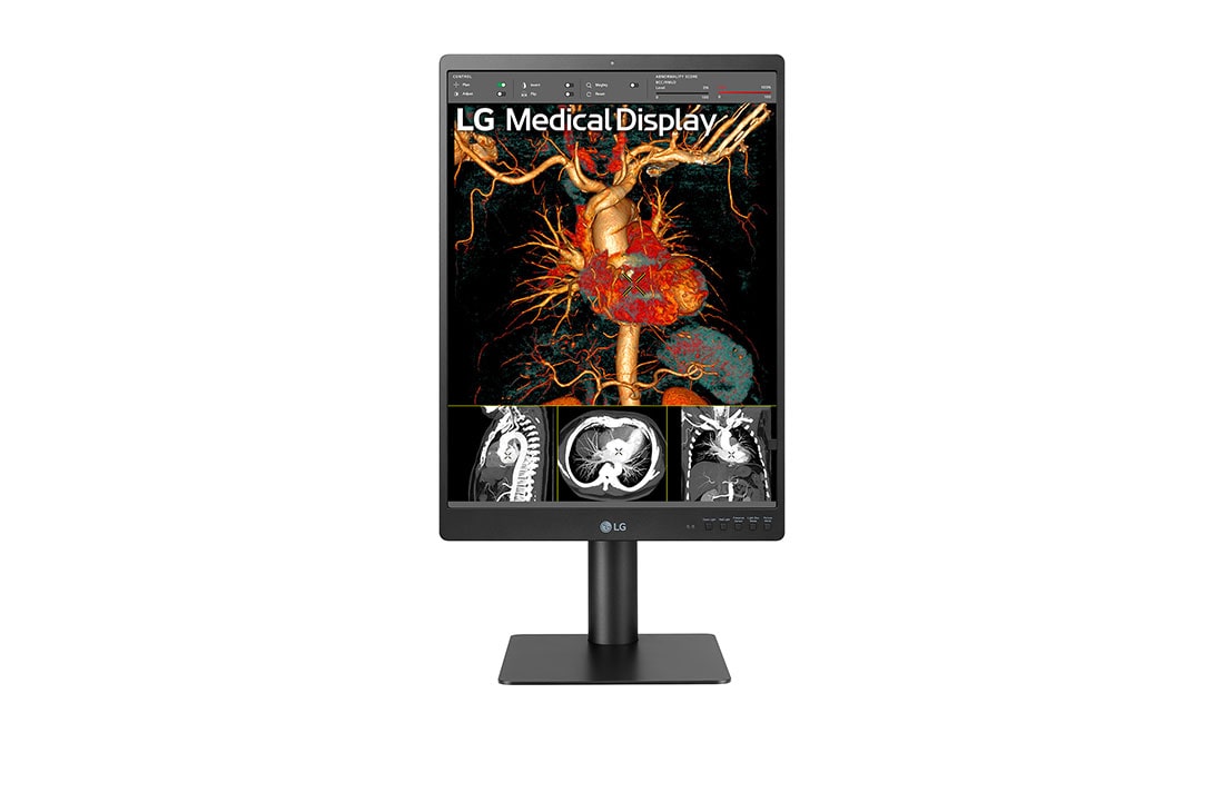 LG Dijagnosti?ki monitor LG 21.3'' 3MP IPS, prikaz prednje strane, 21HQ513D-B