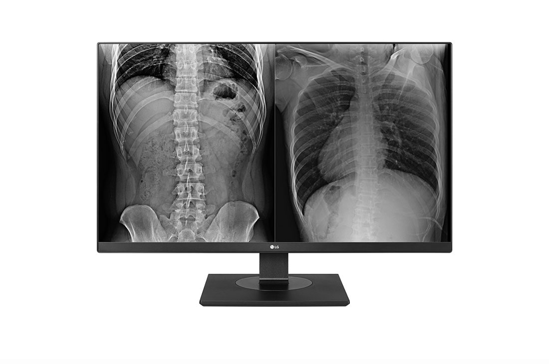LG Monitor de evaluare clinic? LG 8MP, Front view, 27HJ713C-B