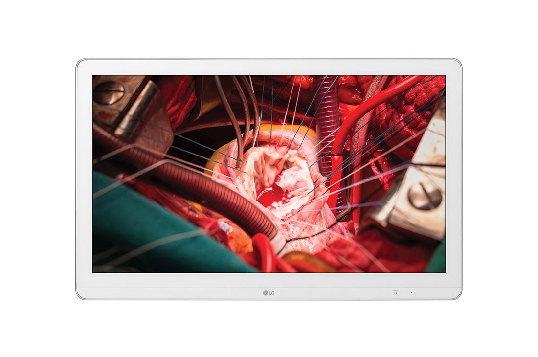 LG 27'' Full HD hirur?ki monitor, 27HK510S-W