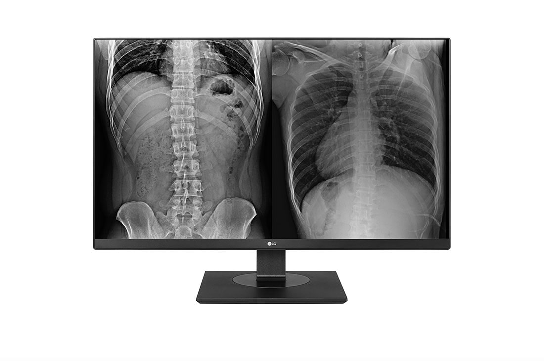 LG 27'' 8MP monitor za klini?ki pregled, 27HJ713C-B