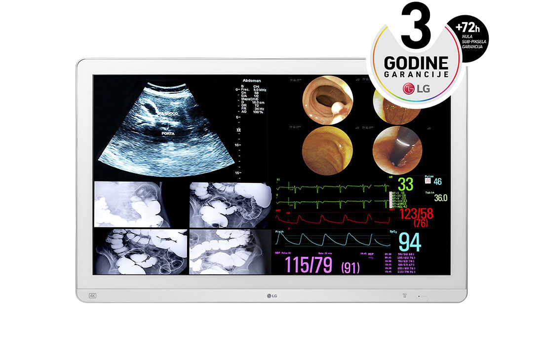 LG 31.5'' 4K IPS hirur?ki monitor, prikaz spreda, 32HL714S-W